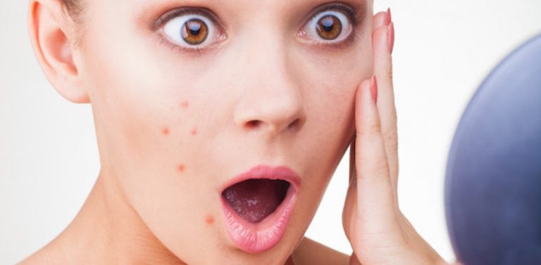 luminotherapie-contre-acne