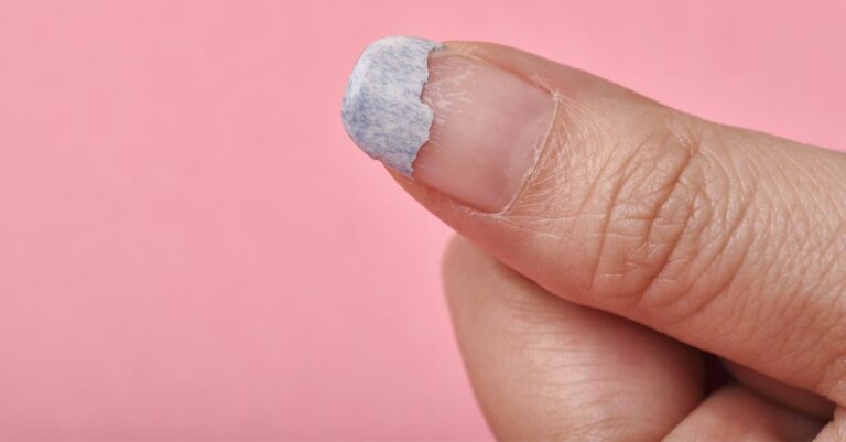 Ongle cassé comment faire pour le réparer Voici la technique infaillible, et nos conseils pour que cela ne se reproduise pas !