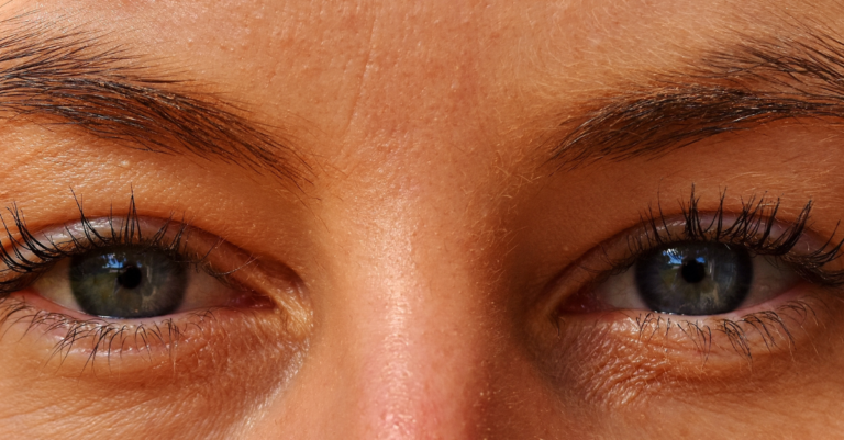 Poches sous les yeux Quels sont les soins du visage recommandés pour faire disparaître votre air fatigué