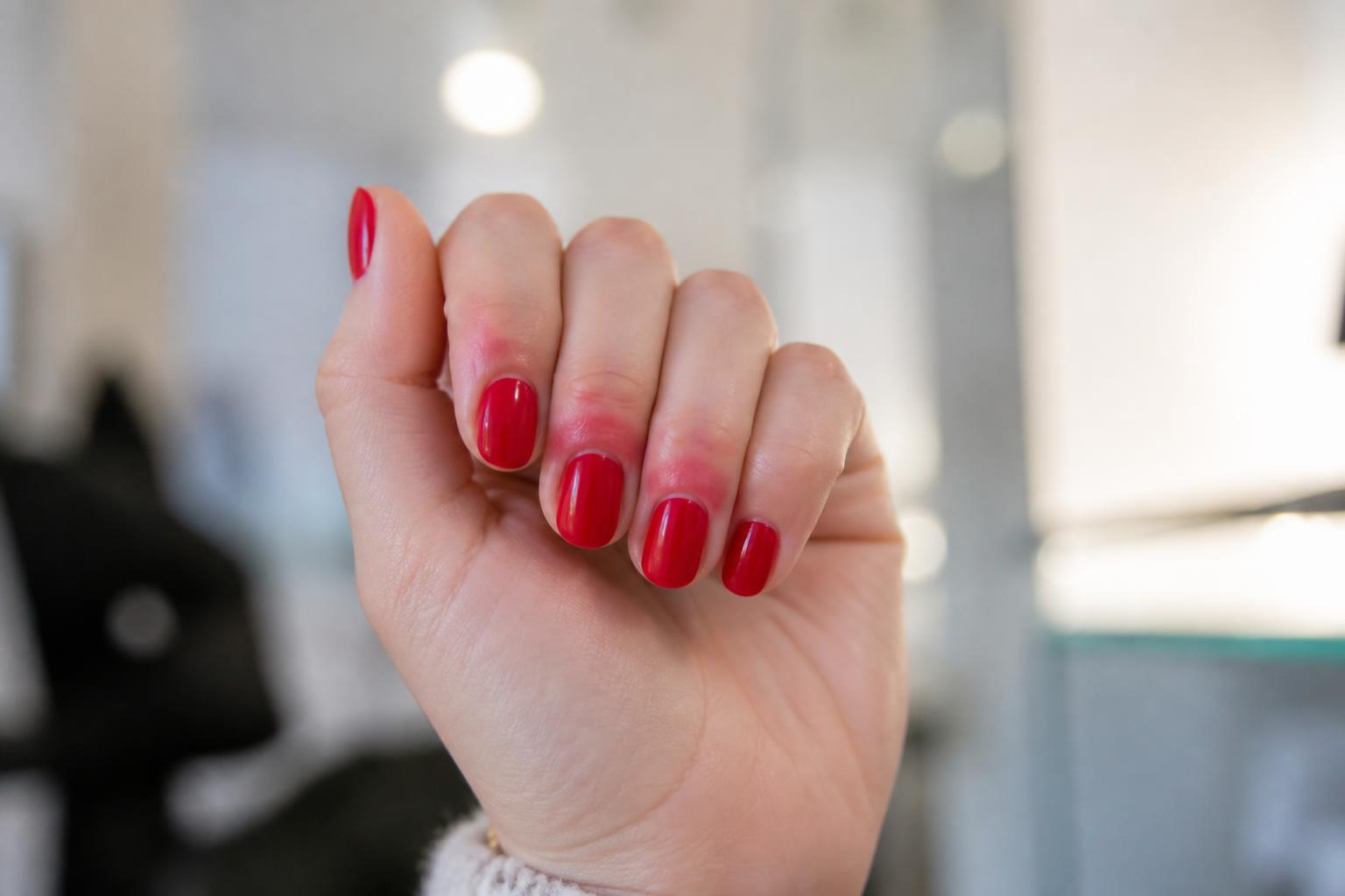 découvrez les causes des démangeaisons après un vernis semi-permanent et comment les prévenir pour garder des ongles beaux et en bonne santé.