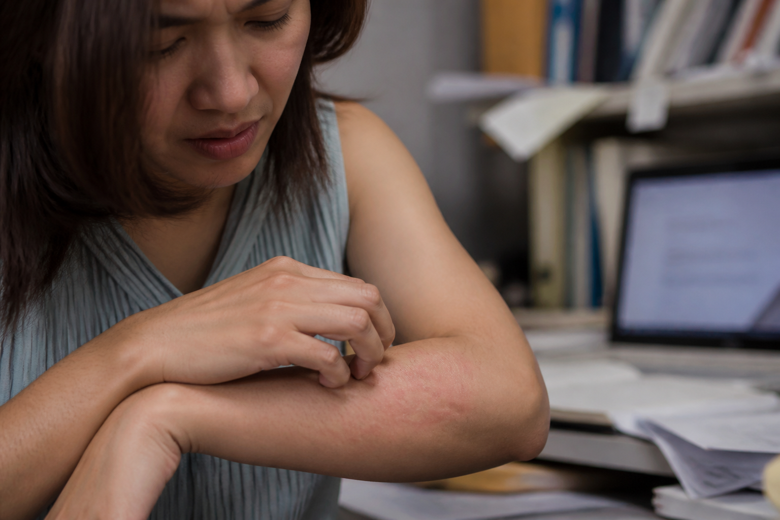 Urticaire de stress : reconnaître les signes et savoir quand consulter